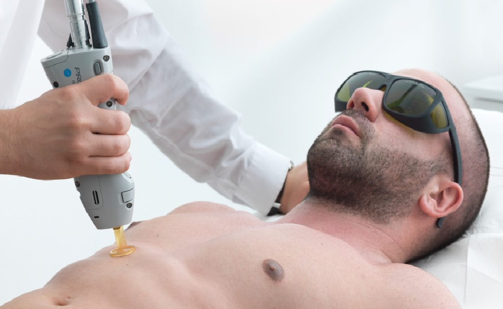 Why the epilating procedure is important for men? Perfect image equals success