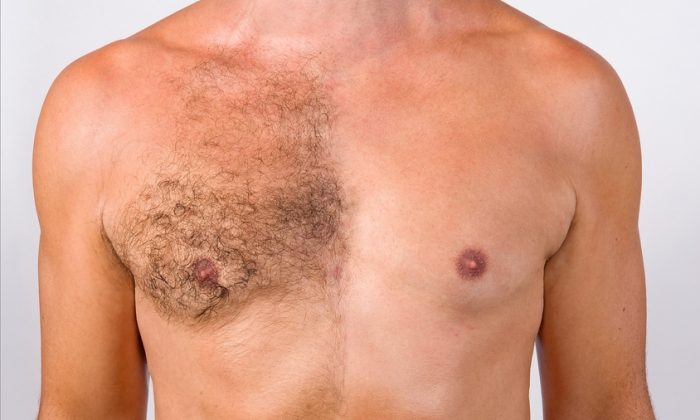 Smooth chest: why to remove unwanted hair is so demanded in that area?