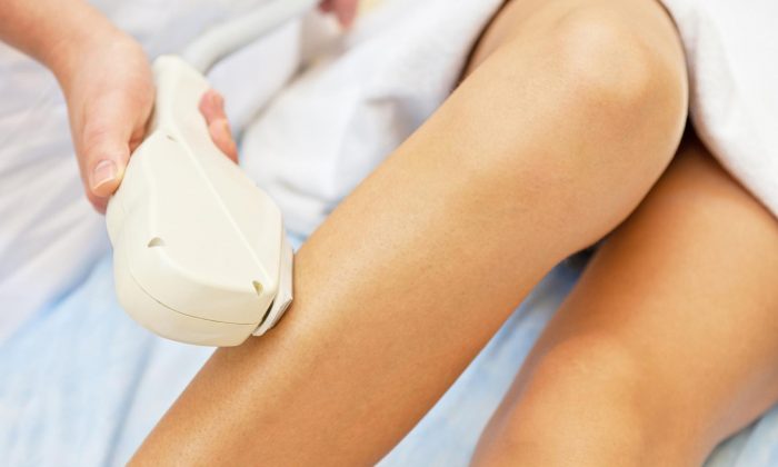 What are the key reasons of laser epilation complications?