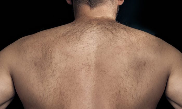 Removing unwanted hair from back area: which method is considered as the best one?